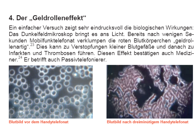 Geldrollen